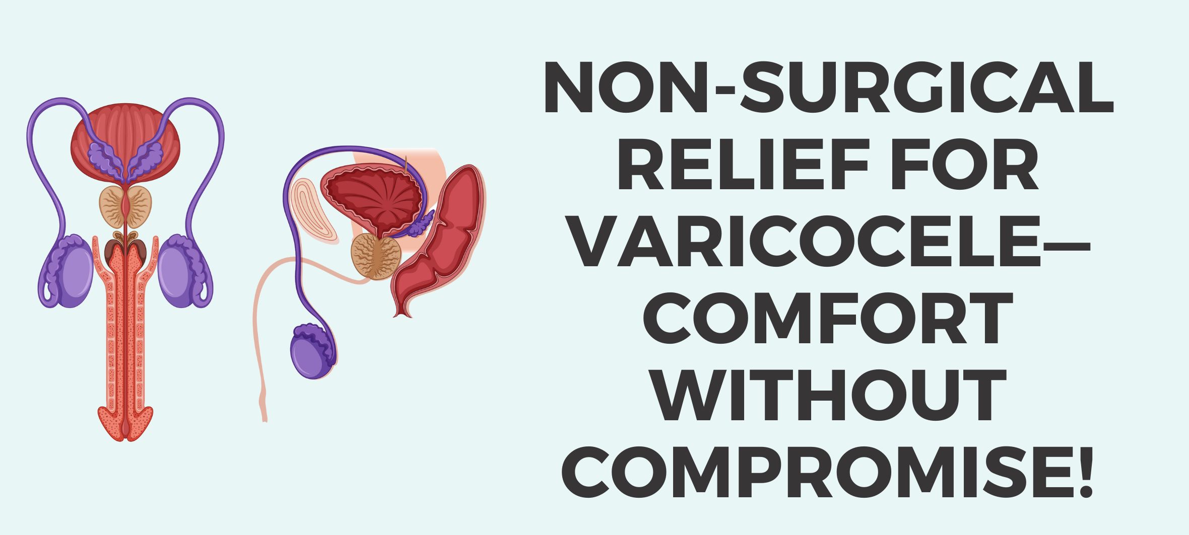 Varicocele Embolization